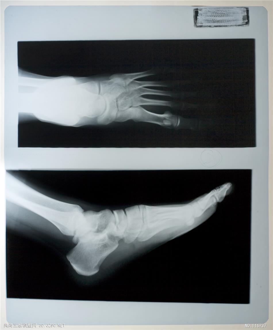 x-rays-x射線feet-腳-材質貼圖材質貼圖